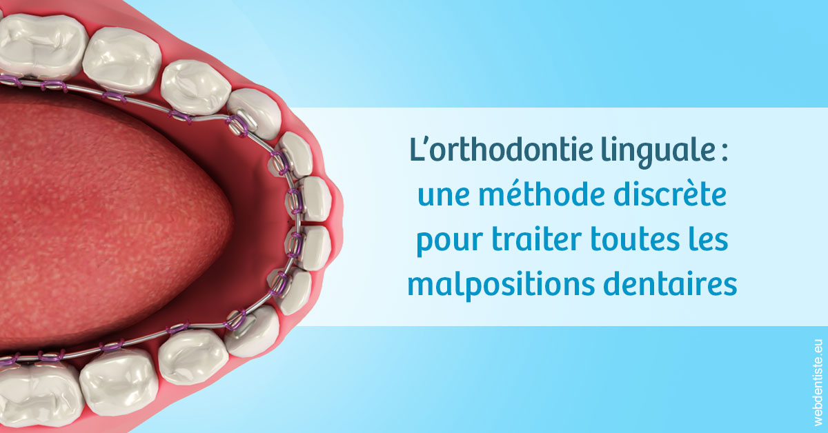 https://selarl-cabdentaire-idrissi.chirurgiens-dentistes.fr/L'orthodontie linguale 1