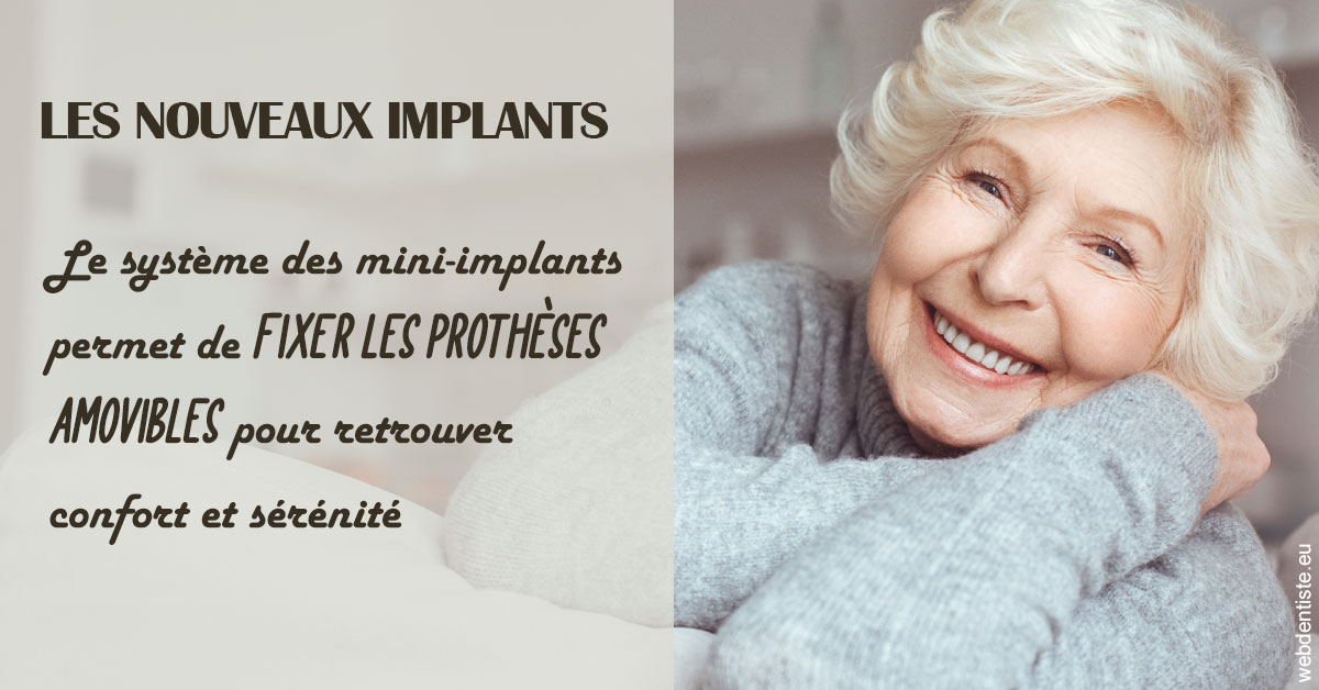 https://selarl-cabdentaire-idrissi.chirurgiens-dentistes.fr/Les nouveaux implants 1