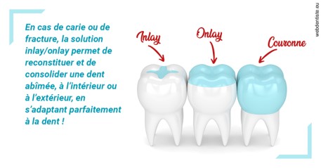 https://selarl-cabdentaire-idrissi.chirurgiens-dentistes.fr/L'INLAY ou l'ONLAY