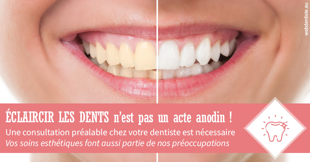 https://selarl-cabdentaire-idrissi.chirurgiens-dentistes.fr/Eclaircir les dents 1