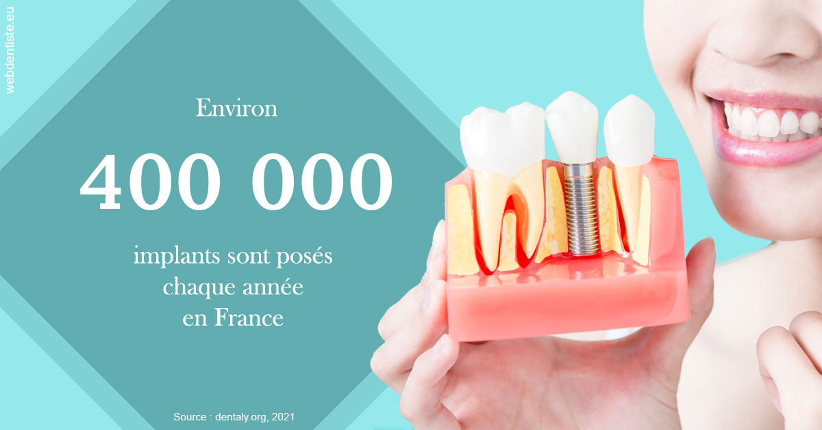 https://selarl-cabdentaire-idrissi.chirurgiens-dentistes.fr/Pose d'implants en France 2
